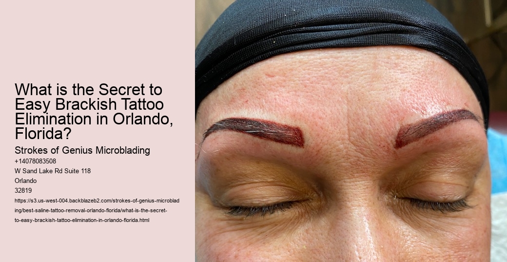 What is the Secret to Easy Brackish Tattoo Elimination in Orlando, Florida?