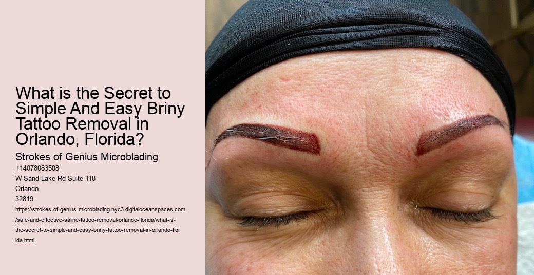 What is the Secret to Simple And Easy Briny Tattoo Removal in Orlando, Florida?