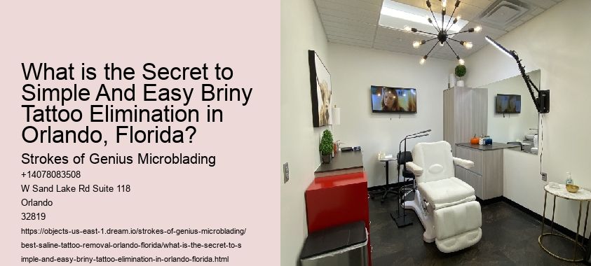 What is the Secret to Simple And Easy Briny Tattoo Elimination in Orlando, Florida?