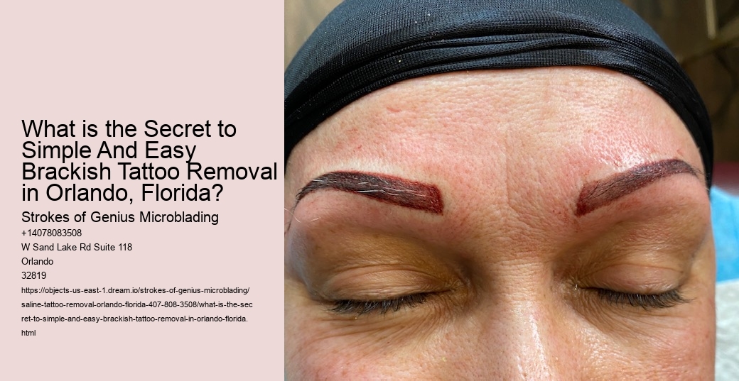 What is the Secret to Simple And Easy Brackish Tattoo Removal in Orlando, Florida?