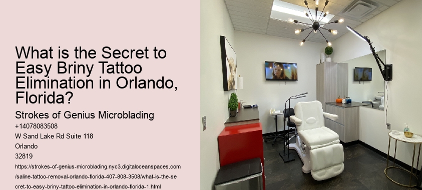 What is the Secret to Easy Briny Tattoo Elimination in Orlando, Florida?