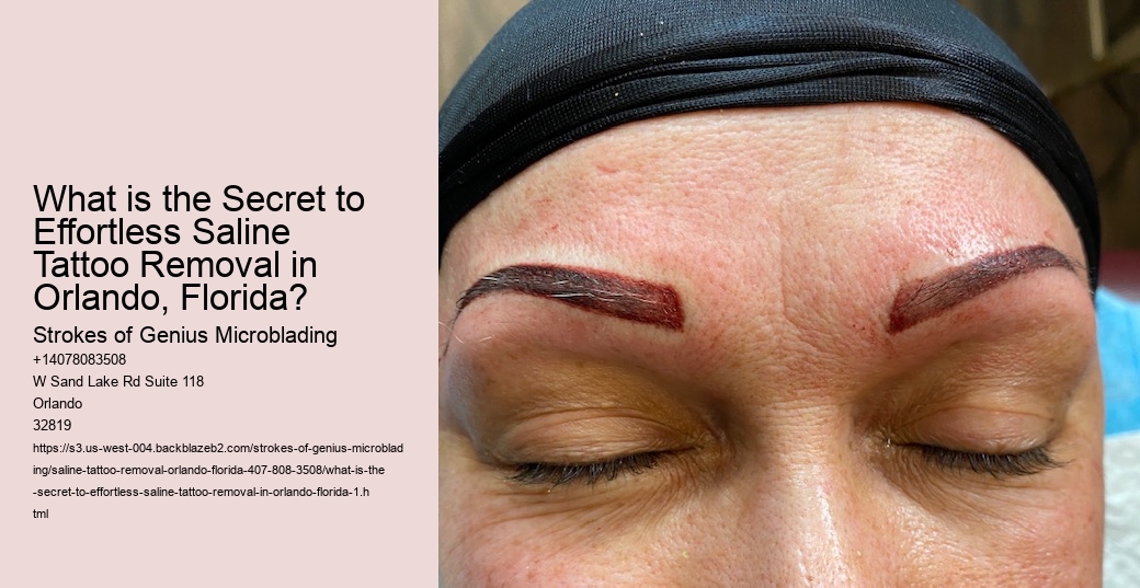 What is the Secret to Effortless Saline Tattoo Removal in Orlando, Florida?
